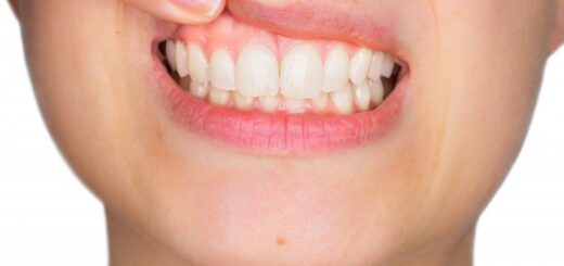 Why Taking Care of Your Gums Is Essential for Overall Health?
